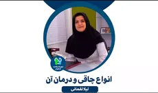  انواع چاقی و درمان آن- لیلا لقمانی